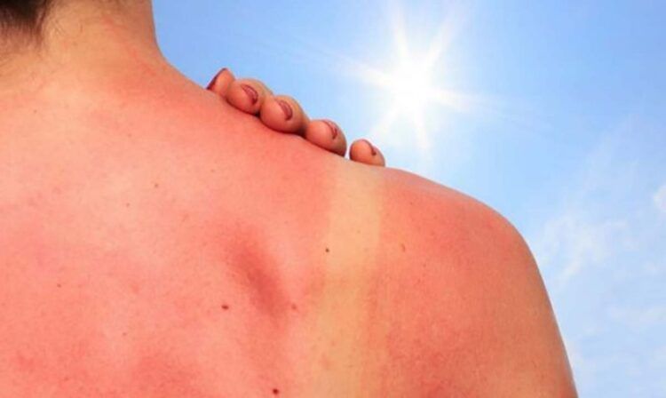 COFCR: ¿Cuál es la mejor protección para que el sol no queme nuestra piel?