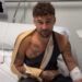 Dani Fernández, intervenido de urgencia tras sufrir una rotura de ligamentos en pleno concierto en Valencia